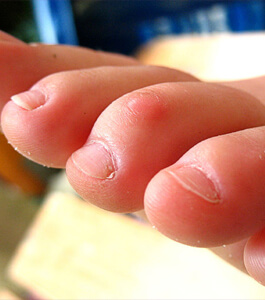 “Ik krijg er kromme tenen van!”